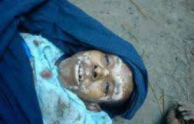 Arakan’da Yaşanan Katliama Dünya Sessiz