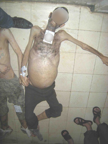 Esed İşkencesi Yeni Fotoğraflarla Belgelendi