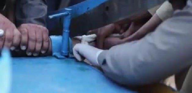 Kağıt kesme makinesiyle elini kestiler