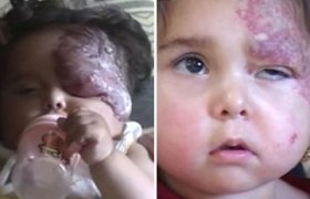 Felluce'de Kimyasal Saldırı